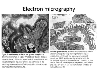 Electron micrography
 