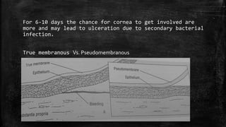 For 6-10 days the chance for cornea to get involved are
more and may lead to ulceration due to secondary bacterial
infection.
True membranous Vs. Pseudomembranous
 