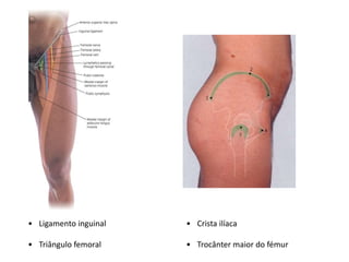 • Ligamento inguinal
• Triângulo femoral
• Crista ilíaca
• Trocânter maior do fémur
 