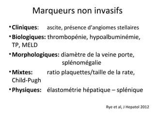 Marqueurs non invasifs
• Cliniques: ascite, présence d’angiomes stellaires
• Biologiques: thrombopénie, hypoalbuminémie,
  TP, MELD
• Morphologiques: diamètre de la veine porte,
                     splénomégalie
• Mixtes:      ratio plaquettes/taille de la rate,
  Child-Pugh
• Physiques: élastométrie hépatique – splénique

                                    Rye et al, J Hepatol 2012
 
