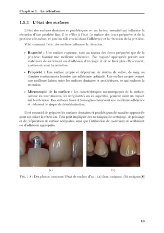 Chapitre 1. La rétention
1.5.3 L’état des surfaces
L’état des surfaces dentaires et prothétiques est un facteur essentiel qui influence la
rétention d’une prothèse fixe. Il se réfère à l’état de surface des dents préparées et de la
prothèse elle-même, et joue un rôle crucial dans l’adhérence et la rétention de la prothèse.
Voici comment l’état des surfaces influence la rétention :
• Rugosité : Une surface rugueuse, tant au niveau des dents préparées que de la
prothèse, favorise une meilleure adhérence. Une rugosité appropriée permet aux
matériaux de scellement ou d’adhésion d’interagir et de se fixer plus eﬀicacement,
améliorant ainsi la rétention.
• Propreté : Une surface propre et dépourvue de résidus de salive, de sang ou
d’autres contaminants favorise une adhérence optimale. Une surface propre permet
une meilleure liaison entre les surfaces dentaires et prothétiques, ce qui renforce la
rétention.
• Microscopie de la surface : Les caractéristiques microscopiques de la surface,
comme les microfissures, les irrégularités ou les aspérités, peuvent avoir un impact
sur la rétention. Des surfaces lisses et homogènes favorisent une meilleure adhérence
et réduisent le risque de désolidarisation.
Il est essentiel de préparer les surfaces dentaires et prothétiques de manière appropriée
pour optimiser la rétention. Cela peut impliquer des techniques de nettoyage, de polissage
et de préparation de surface adéquates, ainsi que l’utilisation de matériaux de scellement
ou d’adhésion appropriés.
(a) (b)
Fig. 1.8 : Des photos montrant l’état de surface d’un : (a) faux moignon, (b) moignon[8]
10
 