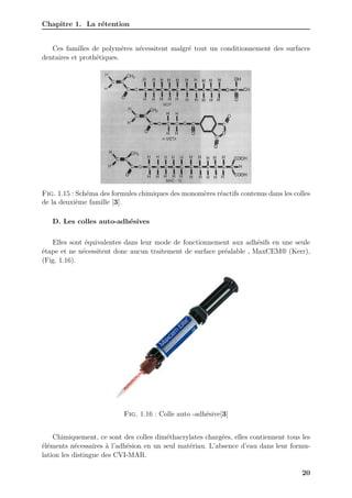 Chapitre 1. La rétention
Ces familles de polymères nécessitent malgré tout un conditionnement des surfaces
dentaires et prothétiques.
Fig. 1.15 : Schéma des formules chimiques des monomères réactifs contenus dans les colles
de la deuxième famille [3].
D. Les colles auto-adhésives
Elles sont équivalentes dans leur mode de fonctionnement aux adhésifs en une seule
étape et ne nécessitent donc aucun traitement de surface préalable , MaxCEM® (Kerr),
(Fig. 1.16).
Fig. 1.16 : Colle auto -adhésive[3]
Chimiquement, ce sont des colles diméthacrylates chargées, elles contiennent tous les
éléments nécessaires à l’adhésion en un seul matériau. L’absence d’eau dans leur formu-
lation les distingue des CVI-MAR.
20
 