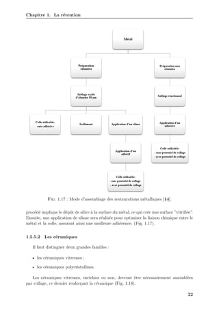 Chapitre 1. La rétention
Fig. 1.17 : Mode d’assemblage des restaurations métalliques [14].
procédé implique le dépôt de silice à la surface du métal, ce qui crée une surface ”vitrifiée”.
Ensuite, une application de silane sera réalisée pour optimiser la liaison chimique entre le
métal et la colle, assurant ainsi une meilleure adhérence. (Fig. 1.17).
1.5.5.2 Les céramiques
Il faut distinguer deux grandes familles :
• les céramiques vitreuses ;
• les céramiques polycristallines.
Les céramiques vitreuses, enrichies ou non, devront être nécessairement assemblées
par collage, ce dernier renforçant la céramique (Fig. 1.18).
22
 