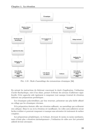 Chapitre 1. La rétention
Fig. 1.18 : Mode d’assemblage des restaurations céramiques [14].
En suivant les instructions du fabricant concernant la durée d’application, l’utilisation
d’acide fluorhydrique, suivi d’un silane, permet d’obtenir des niveaux d’adhérence signi-
ficatifs. Cette approche aide également à compenser tout manque éventuel de rétention
inhérent aux préparations prothétiques .
Les céramiques polycristallines, par leur structure, présentent une plus faible aﬀinité
au collage que les céramiques vitreuses.
Si la préparation dentaire offre une rétention suﬀisante, un assemblage par scellement
sera adéquat. Dans le cas où la rétention est insuﬀisante, les colles auto-adhésives seront
faciles à utiliser et pourront compenser ce manque sans nécessiter de traitement de surface
complexe.
Les préparations périphériques, en évoluant, devenant de moins en moins mutilantes,
mais n’étant plus « rétentives intrinsèquement », l’utilisation de colles avec fort potentiel
adhésif devient nécessaire.
23
 