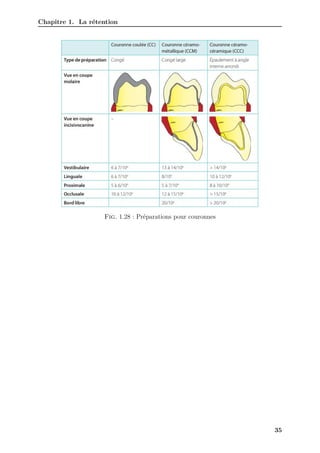 Chapitre 1. La rétention
Fig. 1.28 : Préparations pour couronnes
35
 