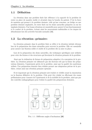 Chapitre 1. La rétention
1.1 Définition
La rétention dans une prothèse fixée fait référence à la capacité de la prothèse de
rester en place de manière stable et sécurisée dans la bouche du patient. C’est la force
de maintien qui permet à la prothèse dentaire, telle qu’une couronne, un bridge ou une
prothèse dentaire implantée, de rester fixée sur les dents naturelles préparées ou sur les
implants dentaires. Une bonne rétention est essentielle pour assurer le bon fonctionnement
et le confort de la prothèse, évitant ainsi les mouvements indésirables et les risques de
détachement lors des activités buccales normales [15].
1.2 La rétention -primaire-
La rétention primaire dans la prothèse fixée se réfère à la rétention initiale obtenue
lors de la préparation des dents naturelles pour recevoir la prothèse. Elle est essentielle
pour assurer une fixation solide et stable de la prothèse dès sa mise en place.
Lors de la préparation des dents naturelles, des techniques spécifiques sont utilisées
pour créer des formes et des structures qui favorisent la rétention primaire de la prothèse.
Ainsi que la réalisation de formes de préparation adaptées à la conception de la pro-
thèse. La rétention primaire est influencée par des facteurs tels que la forme des prépa-
rations dentaires, l’ajustement précis de la prothèse, ainsi que la qualité des matériaux
utilisés. Une préparation dentaire bien réalisée permet une adaptation précise de la pro-
thèse, créant ainsi une rétention primaire optimale.
Il est important que la rétention primaire soit évaluée et vérifiée avant la cimentation
ou la fixation définitive de la prothèse. Cela peut être réalisé en effectuant des essais
préliminaires pour s’assurer de l’ajustement et de la stabilité de la prothèse, ainsi que par
des contrôles radiographiques pour évaluer la qualité des préparations dentaires.
Fig. 1.1 : Différents angles d’inclinaison [20]
3
 
