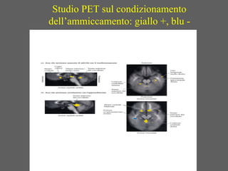 Studio PET sul condizionamento
dell’ammiccamento: giallo +, blu -
 