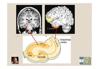 C. Entorrinal
CPFL
A B
 