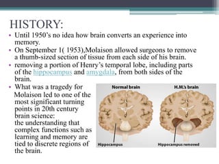HISTORY:
• Until 1950’s no idea how brain converts an experience into
memory.
• On September 1( 1953),Molaison allowed surgeons to remove
a thumb-sized section of tissue from each side of his brain.
• removing a portion of Henry’s temporal lobe, including parts
of the hippocampus and amygdala, from both sides of the
brain.
• What was a tragedy for
Molaison led to one of the
most significant turning
points in 20th century
brain science:
the understanding that
complex functions such as
learning and memory are
tied to discrete regions of
the brain.
 