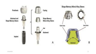 JOURNAL CLUB shape memory abutment.pptx