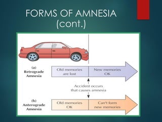 FORMS OF AMNESIA
(cont.)
 