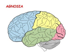 AGNOSIA
 