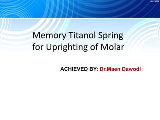 Memory Titanol Spring
for Uprighting of Molar
ACHIEVED BY: Dr.Maen Dawodi
 