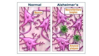 Memória e aprendizagem tudo sobre essa temática