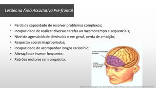 Lesões na Área Associativa Pré-frontal
• Perda da capacidade de resolver problemas complexos;
• Incapacidade de realizar diversas tarefas ao mesmo tempo e sequenciais;
• Nível de agressividade diminuída e em geral, perda de ambição;
• Respostas sociais inapropriadas;
• Incapacidade de acompanhar longos raciocínio;
• Alteração de humor frequente;
• Padrões motores sem propósito.
http://www.google.com.br/imgres?imgurl=http://www.jobairubiratan.com.br//
 