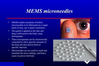 .
MEMS microneedles
• MEMS enables hundreds of hollow
microneedles to be fabricated on a single
patch of area, say a squar...