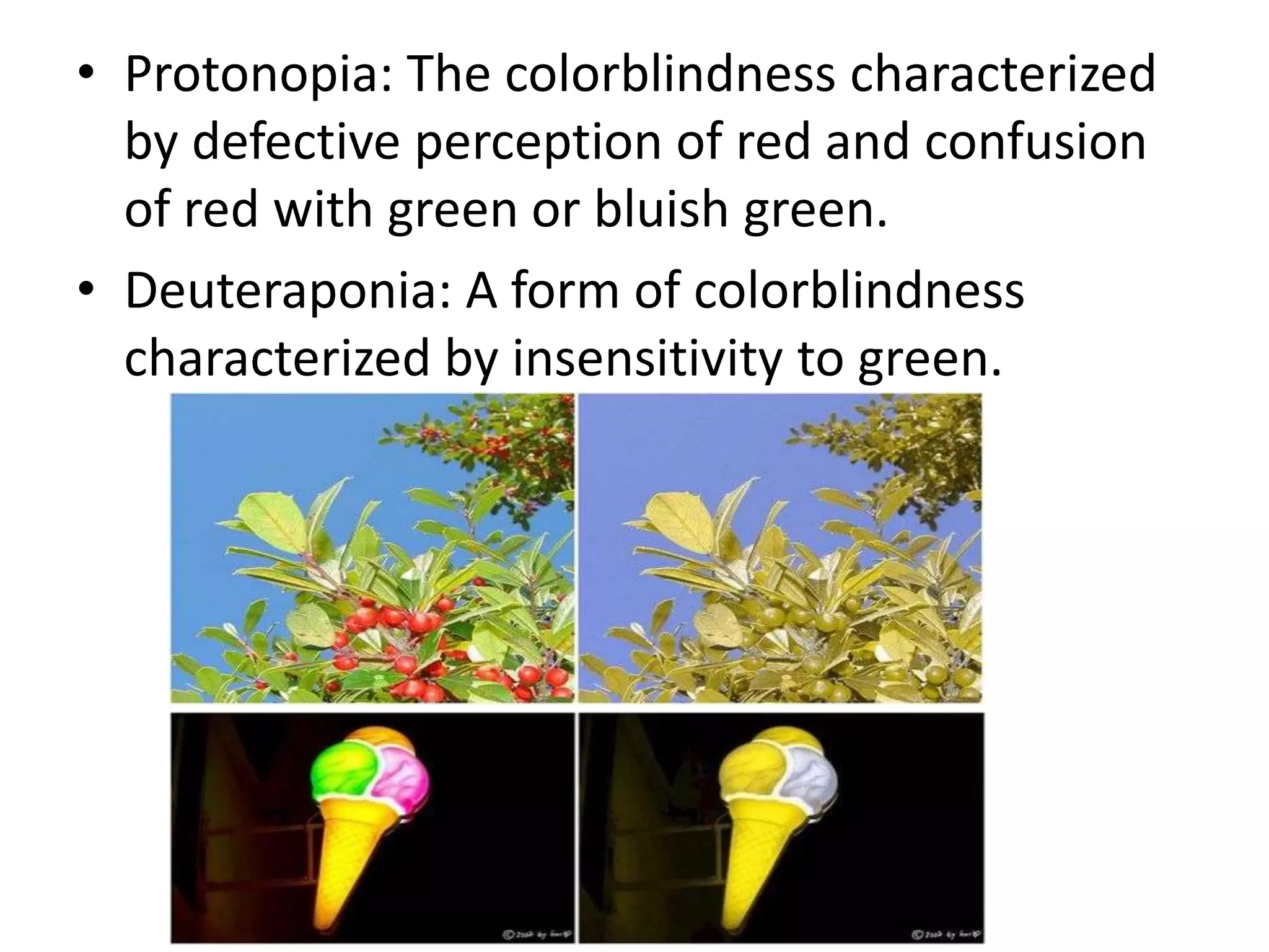 • Protonopia: The colorblindness characterized
by defective perception of red and confusion
of red with green or bluish green.
• Deuteraponia: A form of colorblindness
characterized by insensitivity to green.

 