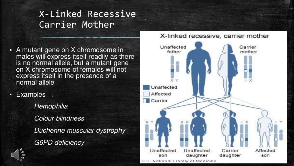 Mendelian (monegenic) disorders Hemophilia
