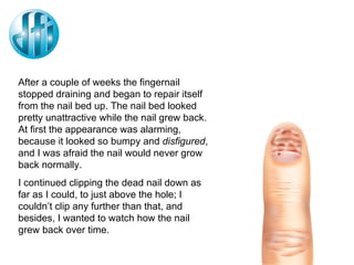 After a couple of weeks the fingernail stopped draining and began to repair itself from the nail bed up. The nail bed looked pretty unattractive while the nail grew back. At first the appearance was alarming, because it looked so bumpy and  disfigured , and I was afraid the nail would never grow back normally. I continued clipping the dead nail down as far as I could, to just above the hole; I couldn’t clip any further than that, and besides, I wanted to watch how the nail grew back over time. 