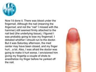 Now I’d done it. There was blood under the fingernail. Although the nail (meaning the  fingernail , and not the “nail” I missed with the hammer) still seemed firmly attached to the nail bed (the underlying tissue), I figured I was probably going to lose my fingernail. I debated whether I should run to the doctor. But it was Saturday afternoon, the med center may have been closed, and my finger hurt…a lot. Also, I was afraid the doctor was going to make it hurt worse. I envisioned him giving my fingertip a couple of shots to anesthetize my finger before he yanked off the nail. 