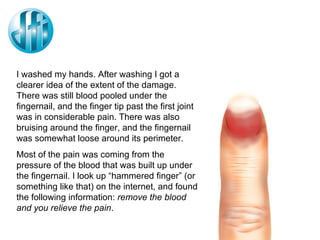 I washed my hands. After washing I got a clearer idea of the extent of the damage. There was still blood pooled under the fingernail, and the finger tip past the first joint was in considerable pain. There was also bruising around the finger, and the fingernail was somewhat loose around its perimeter. Most of the pain was coming from the pressure of the blood that was built up under the fingernail. I look up “hammered finger” (or something like that) on the internet, and found the following information:  remove the blood and you relieve the pain . 