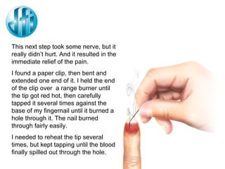 This next step took some nerve, but it really didn’t hurt. And it resulted in the immediate relief of the pain. I found a paper clip, then bent and extended one end of it. I held the end of the clip over  a range burner until the tip got red hot, then carefully tapped it several times against the base of my fingernail until it burned a hole through it. The nail burned through fairly easily. I needed to reheat the tip several times, but kept tapping until the blood finally spilled out through the hole. 