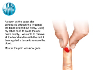 As soon as the paper clip penetrated through the fingernail the blood drained out freely. Using my other hand to press the nail down evenly, I was able to remove all the blood underneath the nail. I then applied a tissue to remove the blood. Most of the pain was now gone. 