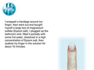 I wrapped a bandage around my finger, then went out and bought myself a large box of magnesium sulfate (Epsom salt). I plugged up the bathroom sink, filled it partially with some hot water, dissolved in a high concentration of Epsom salt, then soaked my finger in the solution for about 10 minutes. 