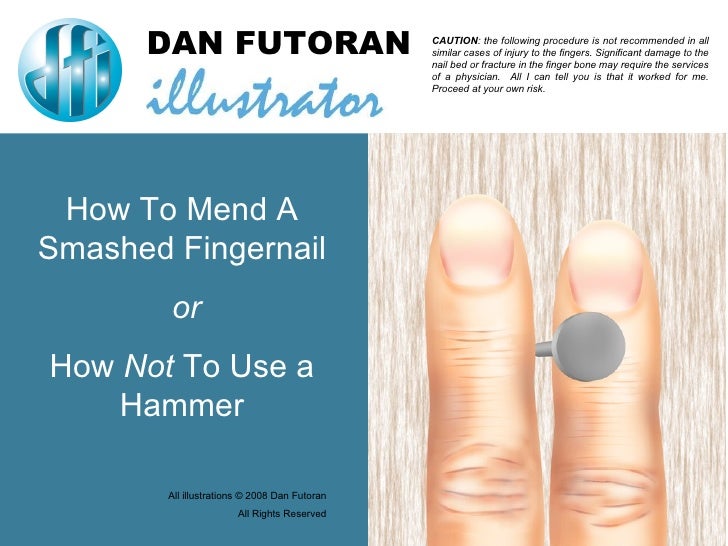 Mending A Smashed Finger