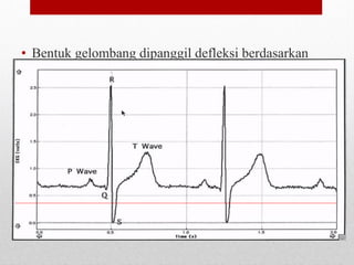 • Bentuk gelombang dipanggil defleksi berdasarkan
kepada garisan isoelektrik (Isoelectric Line)
 