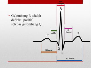 • Gelombang R adalah
defleksi positif
selepas gelombang Q
 