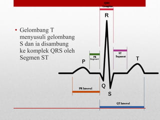 • Gelombang T
menyusuli gelombang
S dan ia disambung
ke komplek QRS oleh
Segmen ST
 