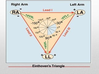 Einthoven's Triangle
 