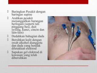  Baringkan Pesakit dengan
baringan supine
 Arahkan pesakit
menanggalkan barangan
berlogam (seperti tali
pinggang besi, duit
syiling, kunci, cincin dan
lain-lain)
 Dedahkan bahagian dada
 Bersihkan kulit dengan
swab alkohol dianggota
dan dada yang hendak
diletakkan elektrod
 Sapukan gel elektrod di
kawasan yang telah
dibersihkan
 