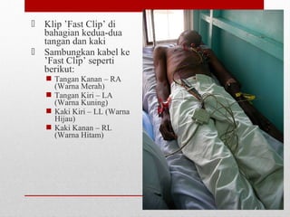  Klip ’Fast Clip’ di
bahagian kedua-dua
tangan dan kaki
 Sambungkan kabel ke
’Fast Clip’ seperti
berikut:
 Tangan Kanan – RA
(Warna Merah)
 Tangan Kiri – LA
(Warna Kuning)
 Kaki Kiri – LL (Warna
Hijau)
 Kaki Kanan – RL
(Warna Hitam)
 