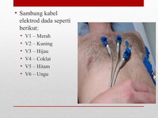 • Sambung kabel
elektrod dada seperti
berikut:
• V1 – Merah
• V2 – Kuning
• V3 – Hijau
• V4 – Coklat
• V5 – Hitam
• V6 – Ungu
 
