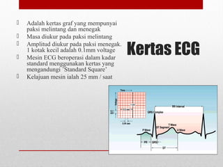 Kertas ECG
 Adalah kertas graf yang mempunyai
paksi melintang dan menegak
 Masa diukur pada paksi melintang
 Amplitud diukur pada paksi menegak.
1 kotak kecil adalah 0.1mm voltage
 Mesin ECG beroperasi dalam kadar
standard menggunakan kertas yang
mengandungi ’Standard Square’
 Kelajuan mesin ialah 25 mm / saat
 