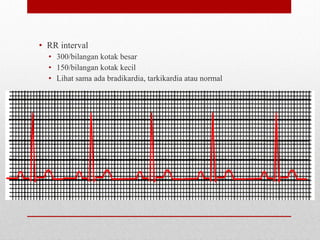 • RR interval
• 300/bilangan kotak besar
• 150/bilangan kotak kecil
• Lihat sama ada bradikardia, tarkikardia atau normal
 