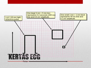 KERTAS ECG
 