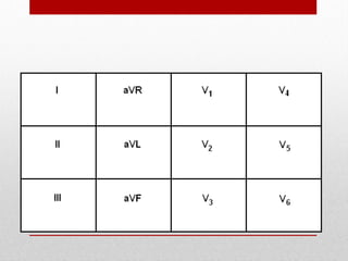 Arrangement of Leads on the EKG
 