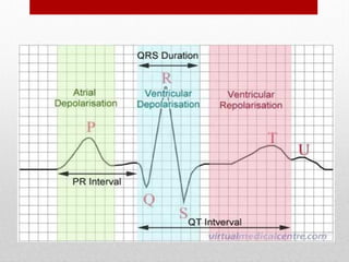 GELOMBANG ECG
 