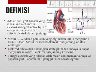 DEFINISI
• Adalah satu graf bacaan yang
dihasilkan oleh mesin
elektrokardiograf untuk tujuan
menganalisa perubahan
aktiviti elektrik dalam jantung
• Mesin ECG adalah peralatan yang digunakan untuk mengambil
ECG 12 lead. Mesin ini merekodkan aktiviti jantung ke atas
kertas graf
• Elektrod diletakkan dibahagian strategik badan supaya ia dapat
menyalurkan aktiviti elektrik dari jantung ke mesin.
• Tenaga elektrik yang dikesan oleh mesin dan menukarkannya ke
paparan graf. Paparan ini dipanggil ’Electrocardiogram’.
 