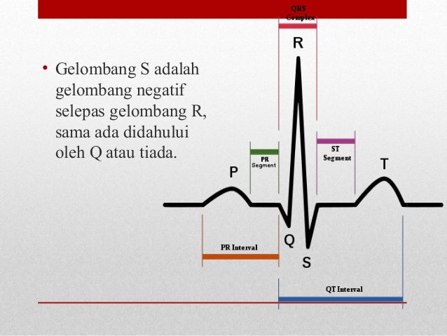 Mengambil Interpretasi E C G