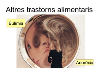 Altres trastorns alimentaris 
Anorèxia 
Bulímia 
 