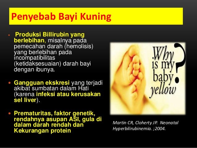 Mengenali bayi kuning dan penanganannya