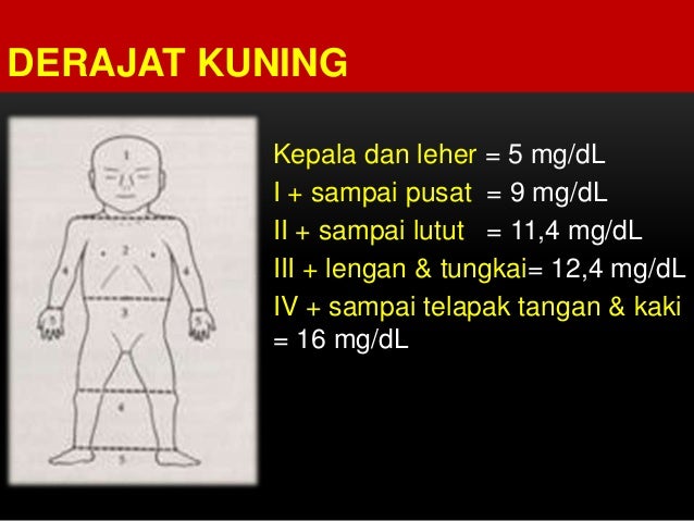 Mengenali bayi kuning dan penanganannya