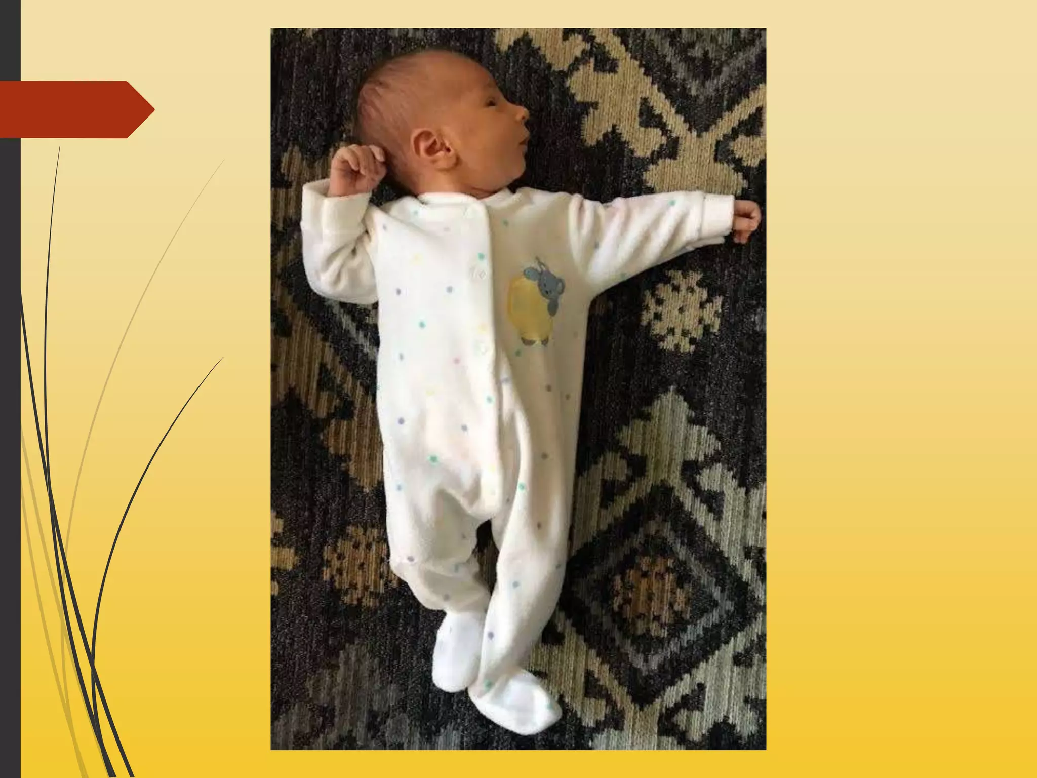 Deteksi Refleks Primitif untuk Pengembangan Anak yang Lebih Baik