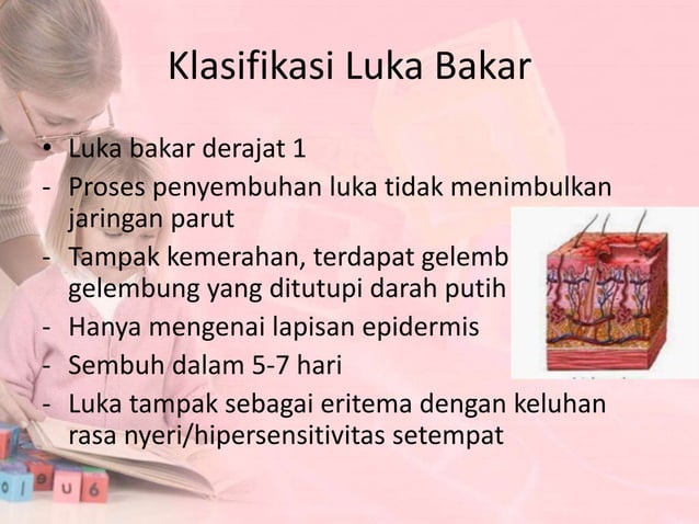 Menghitung luas luka bakar