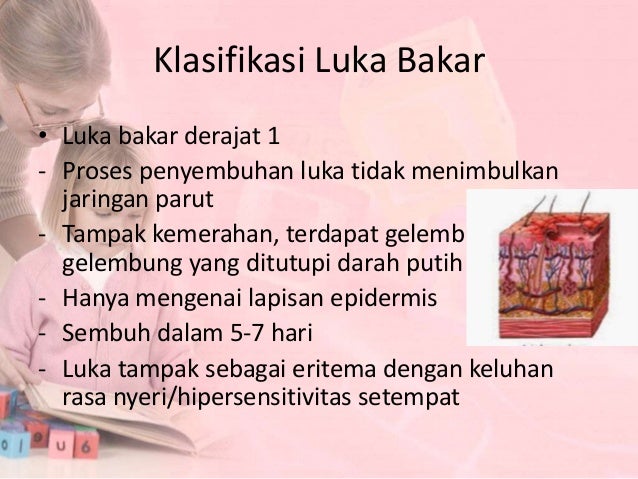 Menghitung luas luka bakar