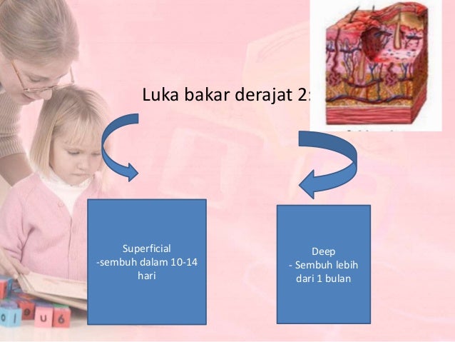 Menghitung luas luka bakar